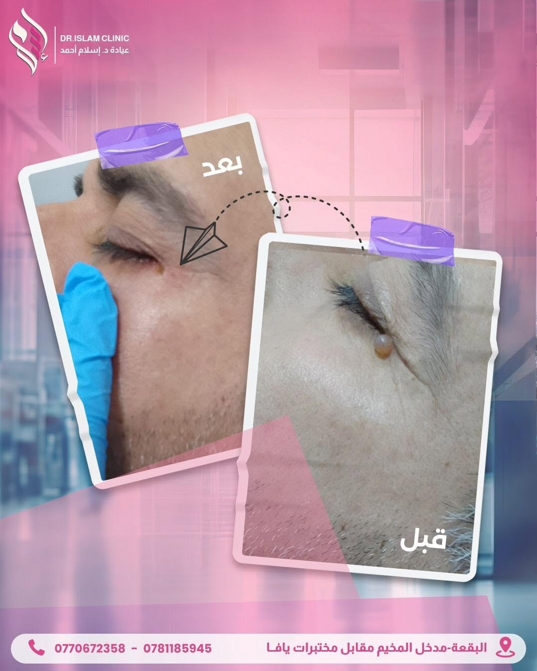 قبل وبعد 3